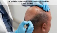 Trasplante de cabelo