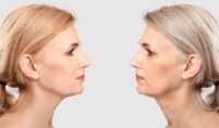 Botox, Restylane, and Juvederm - Restore Your Face to a More Youthful Appearance