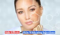 a woman face side effects of whitening injections showing in face