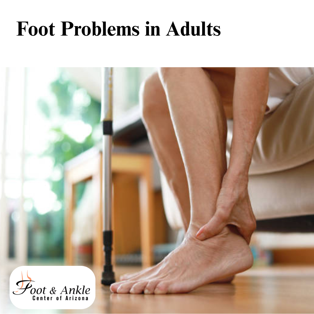Foot Problems in Adults