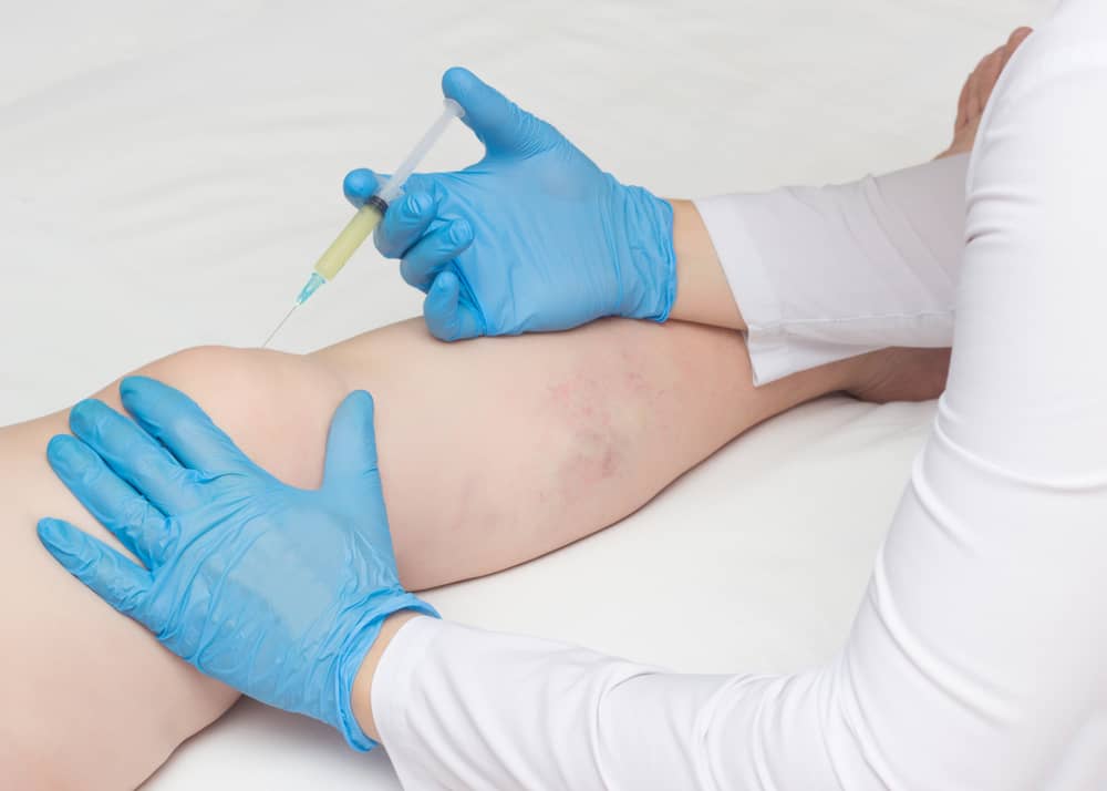 Knee Pain doctor Fidi