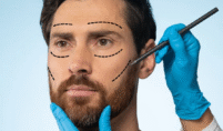 Facelift Surgery in Lahore