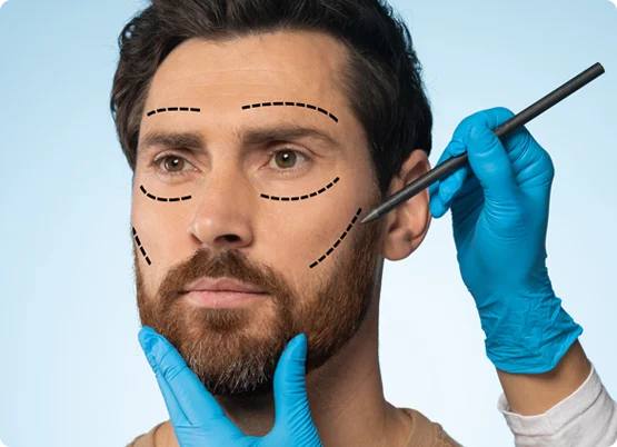 Facelift Surgery in Lahore