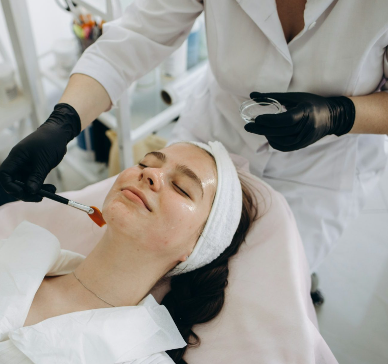 Chemical skin peel Nottingham