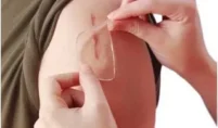 scar removal philadelphia