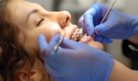 teeth with braces patient