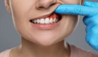  hygienist in Aberdare