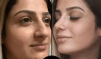 Dubai’s Best Doctors for PRP, Botox, and Anti-Aging Solutions
