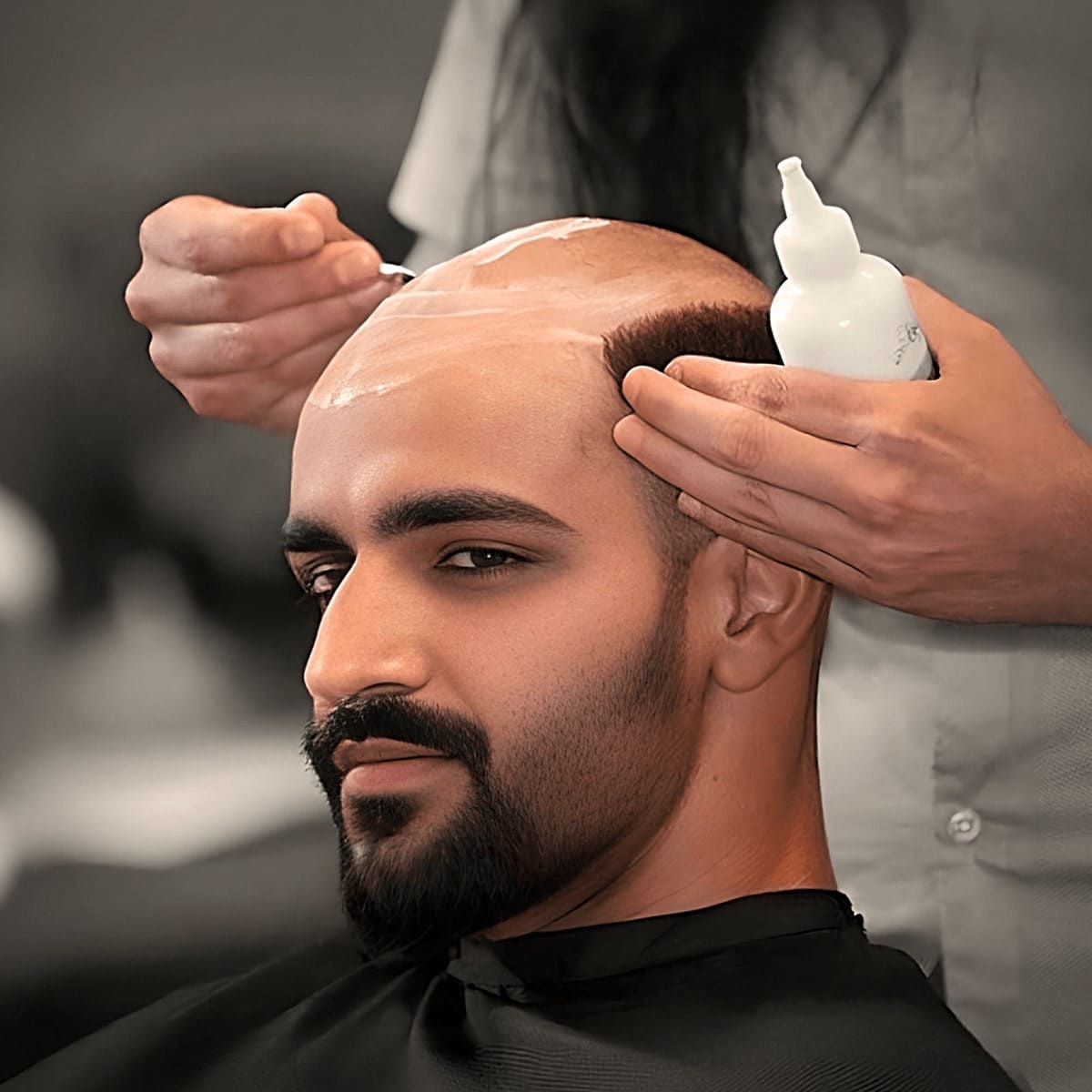 Hair Bonding for Men's