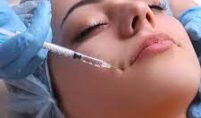 How Long Do Filler Injections Last?