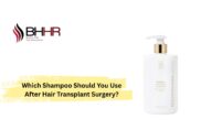 best shampoo after hair transplant,