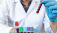 Would a Blood Test Show Something Serious?