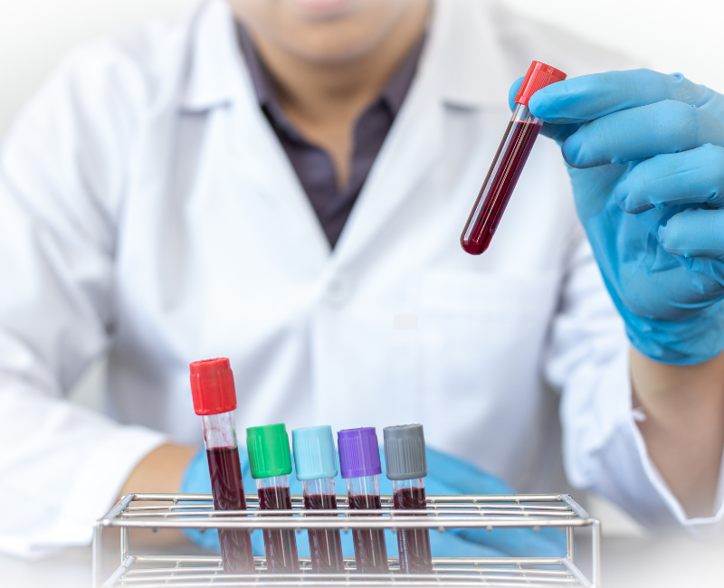 Would a Blood Test Show Something Serious?