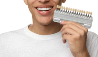 dental veneers sunset hills mo