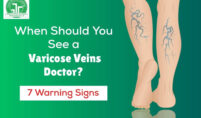 Varicose Veins Doctor