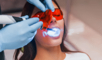 teeth whitening laurel md
