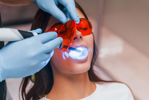 teeth whitening laurel md