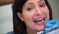 dental composite bonding