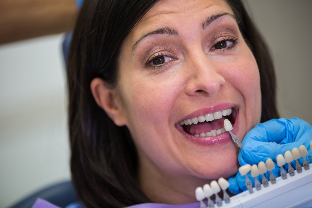 dental composite bonding