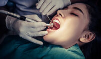 tooth cavity treatment